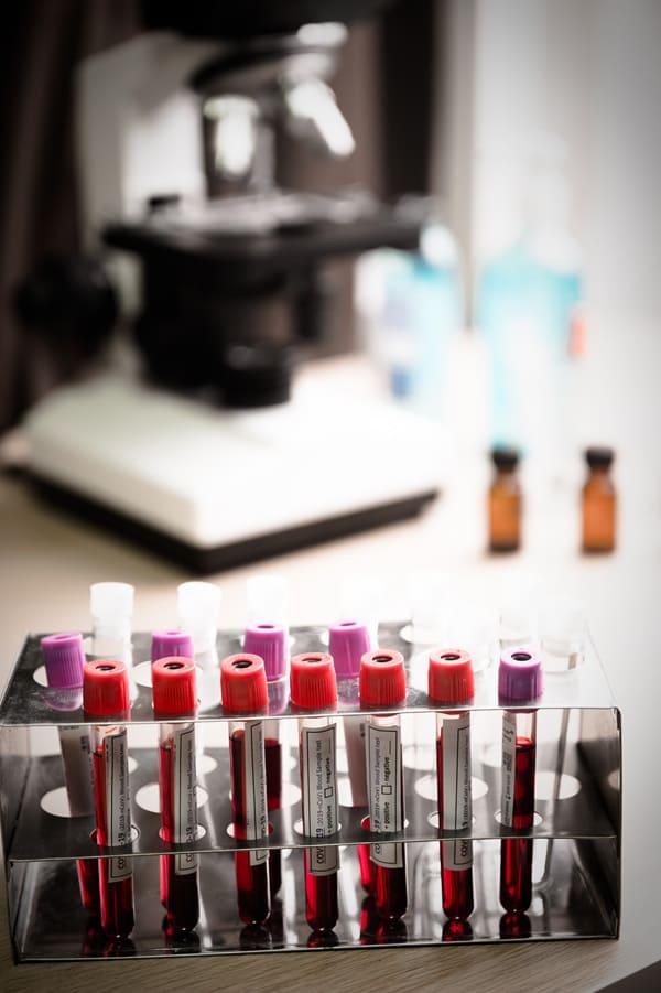 pruebas-de-diagnostico-de-salud-avanzada.jpg
