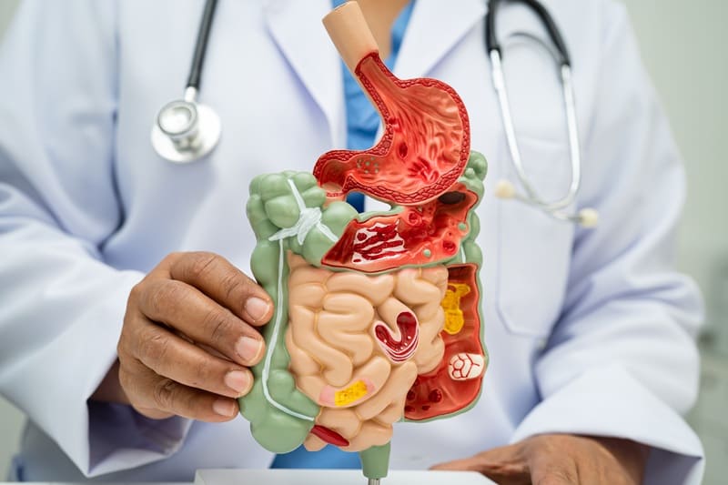 Reparación Intestinal